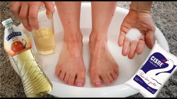 Aquí hay 3 consejos para luchar contra las verrugas y los callos en los pies.