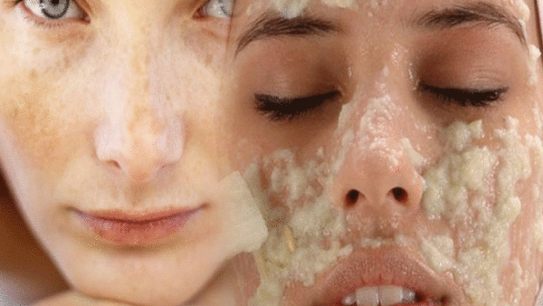 Como elaborar una crema casera natural para eliminar las manchas del rostro