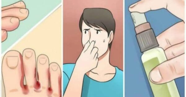 Con estos consejos, ¡elimina el olor a pies sudorosos!