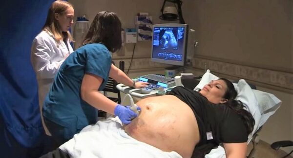 Embarazada acude al doctor por moretones en la barriga y le hacen una ecografía de control