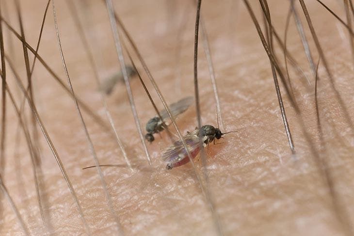 Cuando las moscas se posan sobre ti