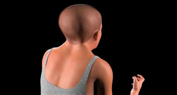 La escalofriante apariencia que podrían tener los humanos en 2100