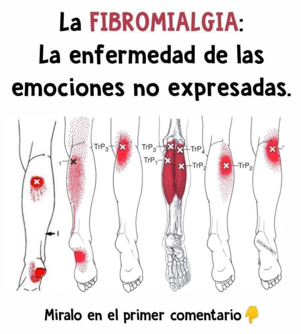 La fibromialgia: La enfermedad de las emociones no expresadas