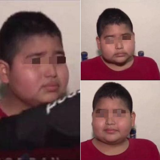 La historia de José Armando el niño que renunció a la Quimio