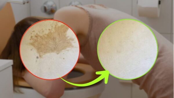 Manchas de vómito en la alfombra, el método casero para quitarlas