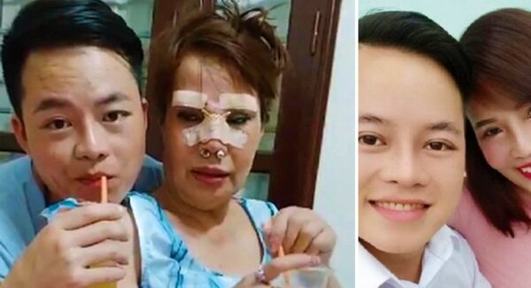 Mujer se realiza operaciones para parecer más joven y casarse con un hombre de 26 años