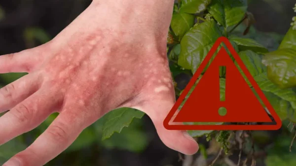 Attenzione a questa pianta che molti coltivano! È tossica: brucia all’istante!