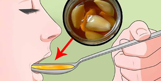 Il rimedio che cura mal di gola e tonsilliti in poche ore