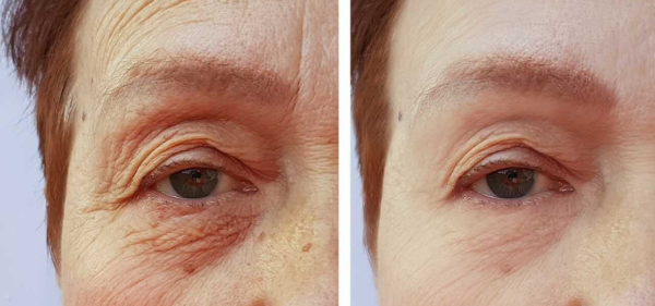 MAI PIÙ IMPERFEZIONI E RUGHE SUL TUO VISO: CONSERVI IL SEGRETO DIRETTAMENTE NEL TUO FRIGO