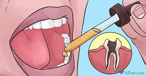 Rimedi naturali contro il mal di denti che il tuo dentista non vuole che tu sappia