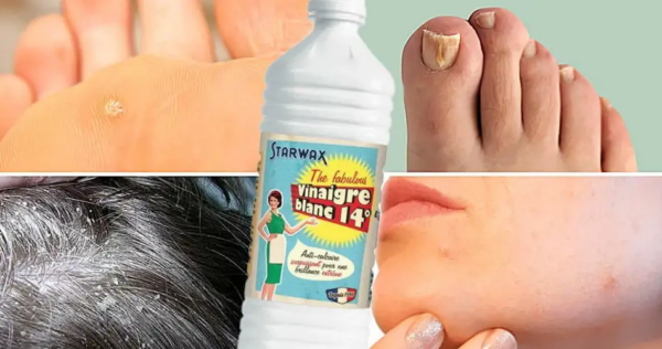 17 usos do vinagre que você não conhecia