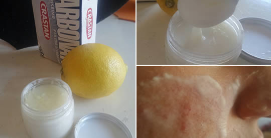 Bicarbonato de sódio, vinagre de maçã e máscara de limão contra cravos e acne
