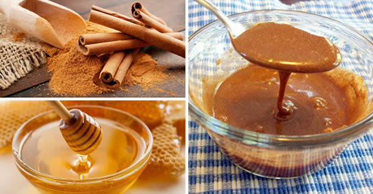 Canela e mel: combine-os assim contra colesterol, diabetes e resfriados