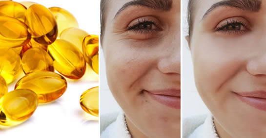 Como eliminar rugas com vitamina E