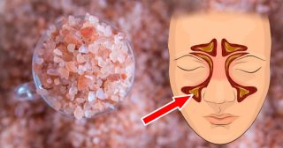 Como inalar sal do Himalaia para eliminar muco, bactérias e toxinas dos pulmões
