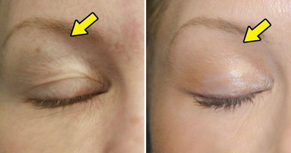 Como levantar as pálpebras com 3 dicas naturais