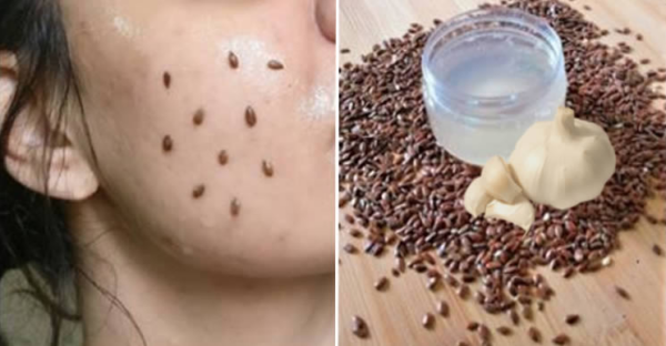 Como preparar um elixir rejuvenescedor à base de linhaça e alho