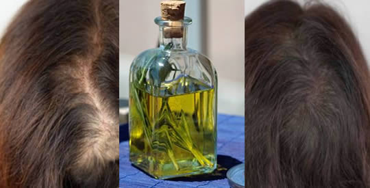 O óleo natural que impede a queda de cabelo e o faz crescer novamente em 2 semanas