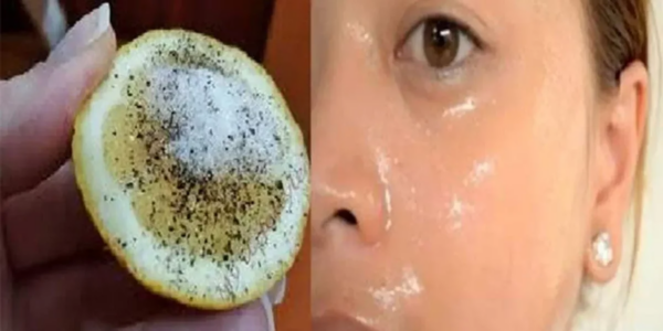 Uma receita de limão para apagar manchas faciais e ter uma pele brilhante