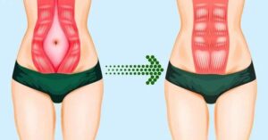 6 Übungen zur Transformation von Bauch, Armen und Beinen in Rekordzeit