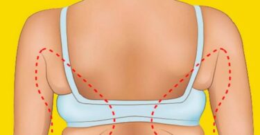 6 magische Übungen zur Reduzierung von Rückenfalten