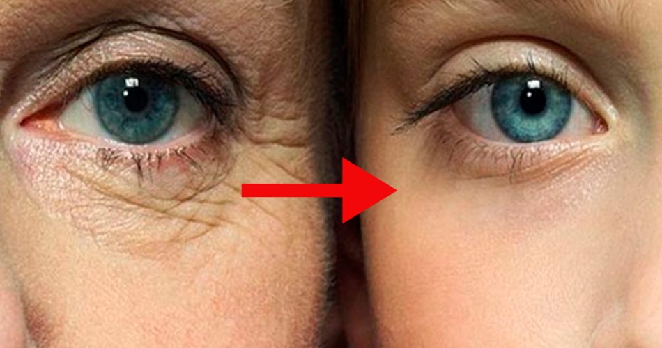 7 einfach zuzubereitende hausgemachte Anti-Falten-Cremes zur Verjüngung der Augenpartie