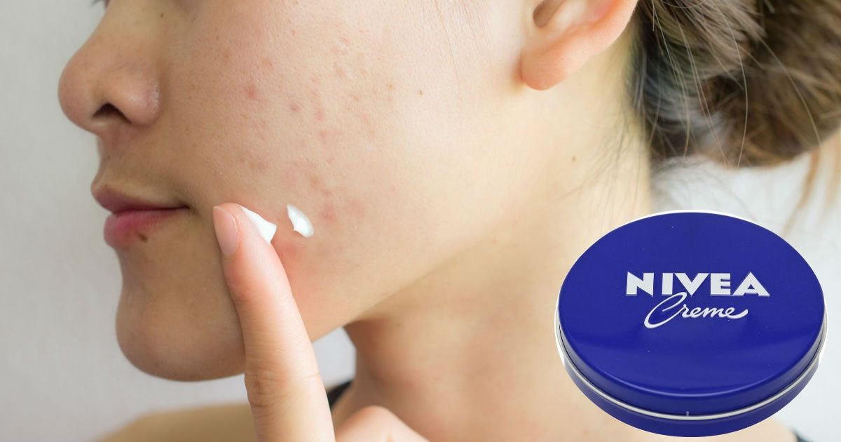 Beauty-Tricks, die mit Nivea-Creme zubereitet werden können