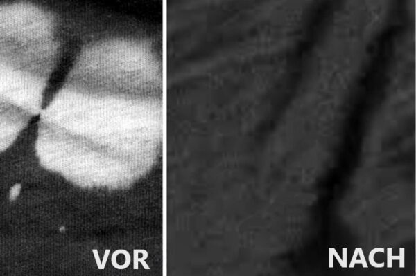 Bleichflecken auf schwarzen Kleidungsstücken? Ich habe das Problem für immer gelöst, entdecken Sie meine Methode!