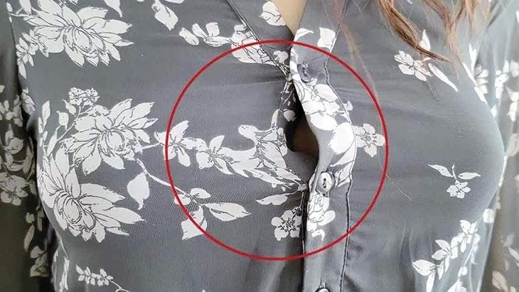 Bluse an der Brust offen? Eine Nadel reicht aus, um dieses lästige Problem zu lösen 2 Hemd klafft zwischen den Knopflöchern