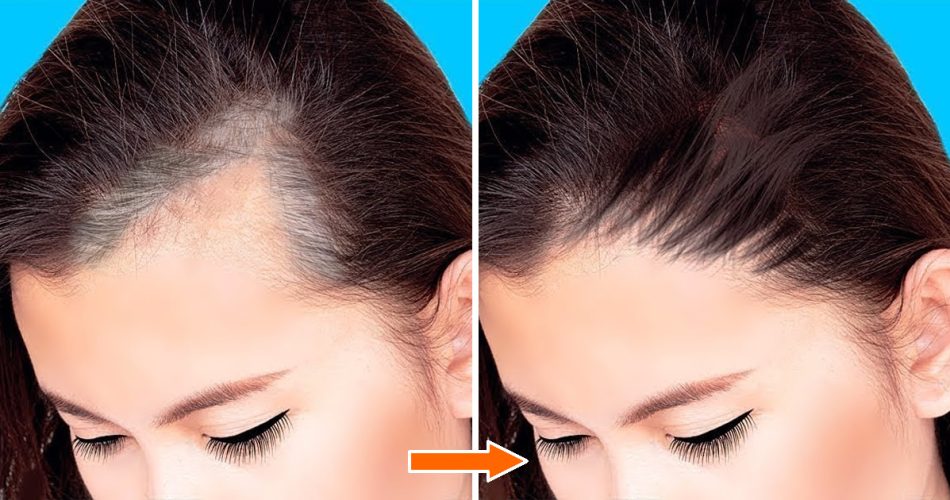 Der natürliche Inhaltsstoff, der den Haarausfall stoppt und das Färbemittel länger halten lässt