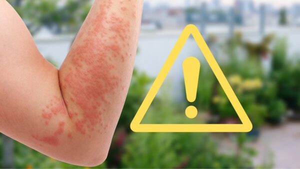 „Es ist sehr giftig“, maximale Aufmerksamkeit: Diese Pflanze ruiniert dich | Du hast es im Garten