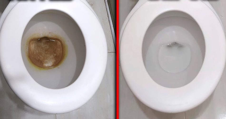 Mit diesem Mittel wird die Toilette in Ihrem Badezimmer wieder so neu aussehen wie am ersten Tag.