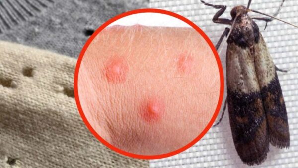 Motten in der Kleidung, nehmen Sie diese wundersame Zutat in die Küche: Sie werden sie für immer los