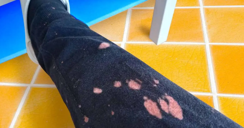 So entfernen Sie ganz einfach einen Bleichfleck aus der Kleidung