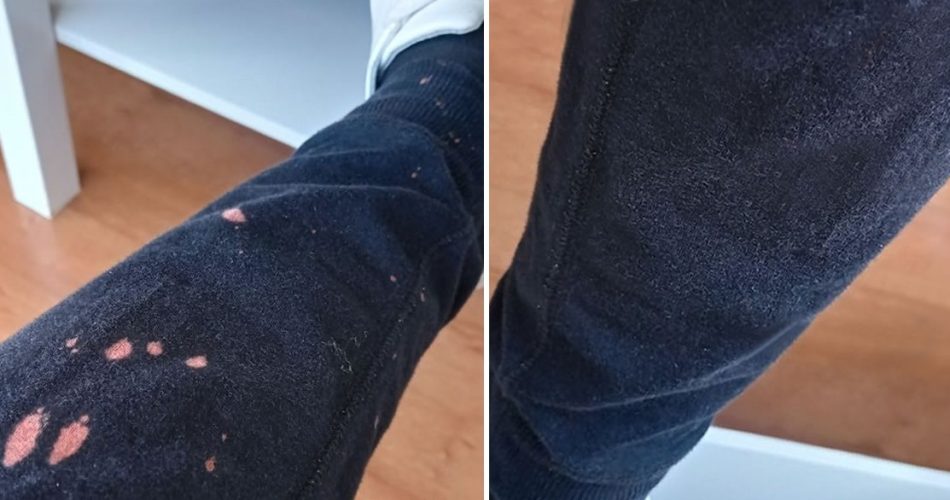 Wie man Bleichflecken auf Stoffen mit 2 Tipps entfernt