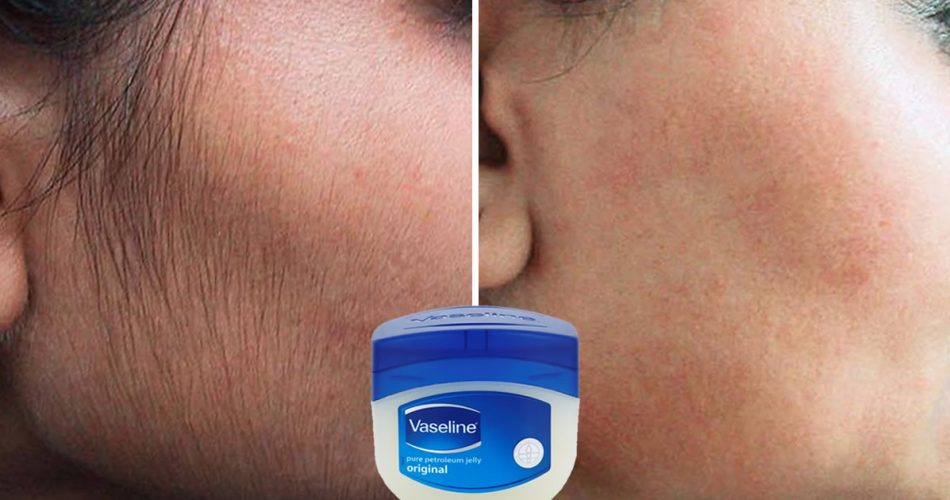Wie man unerwünschte Haare mit Vaseline entfernt