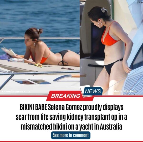 BIKINI BABE Selena Gomez proudly displays scar from life saving kidney transplant op in a mismatched bikini on a yacht in Australia