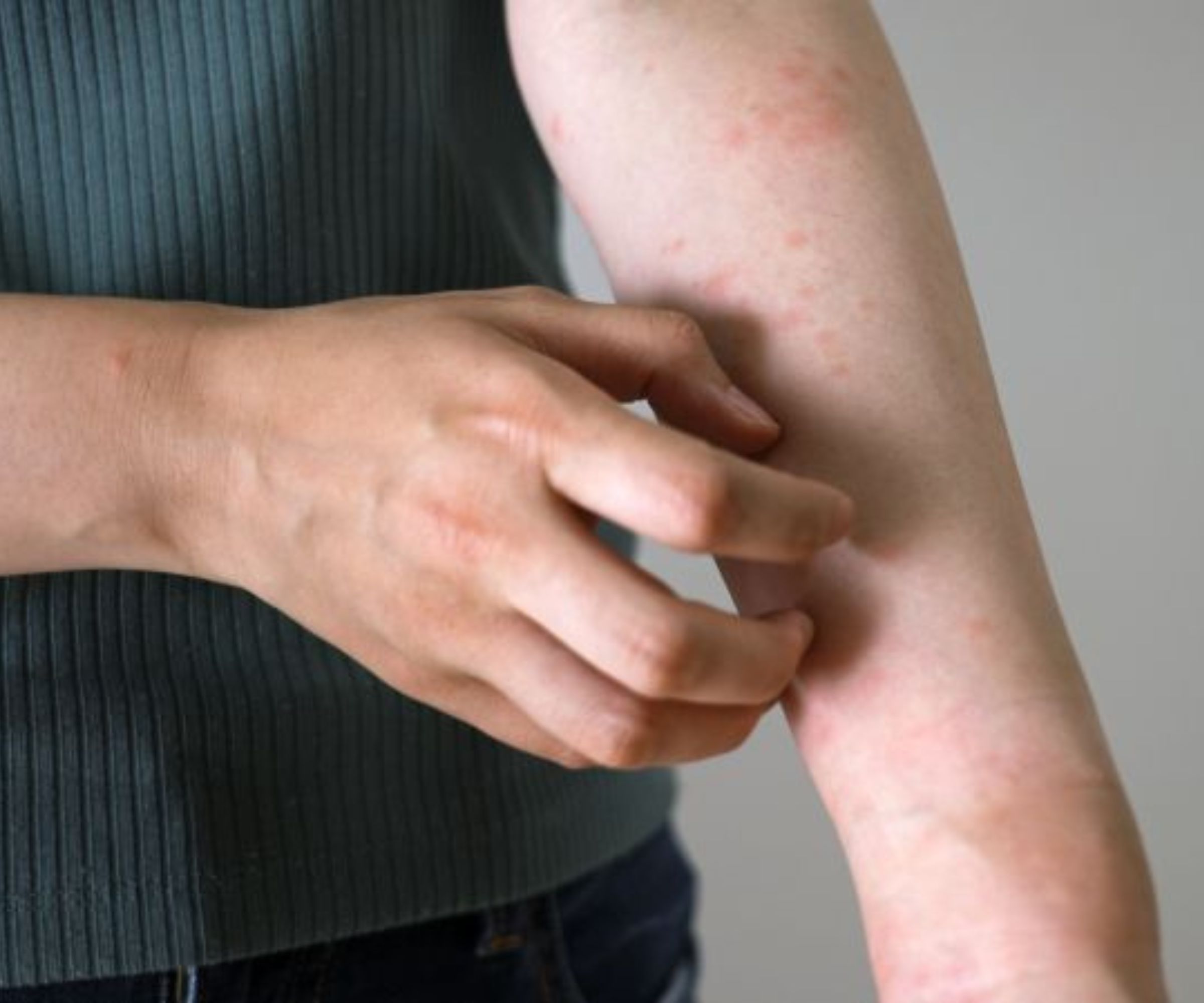 Effektive Methoden zur Bekämpfung von Bettwanzen: Tipps für ein Bettwanzenfreies Zuhause