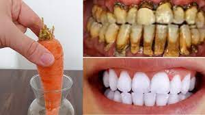 Zahnaufhellung in 2 Minuten: Machen Sie Ihre Zähne mit einer natürlichen Methode zu Hause so weiß und glänzend wie Milch!