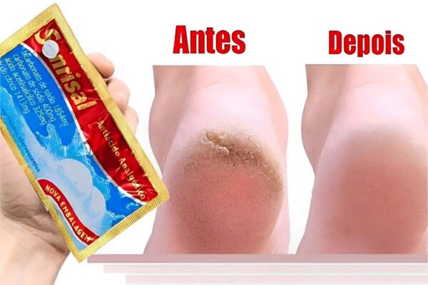 Como hidratar pés rachados com uma misturinha caseira de apenas 3 ingredientes