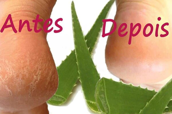 Como tirar rachaduras dos pés usando apenas 3 ingredientes naturais