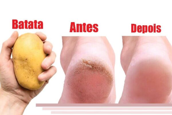 Depois que você aprender como deixar seus pés lisos sua vida vai ficar muito fácil