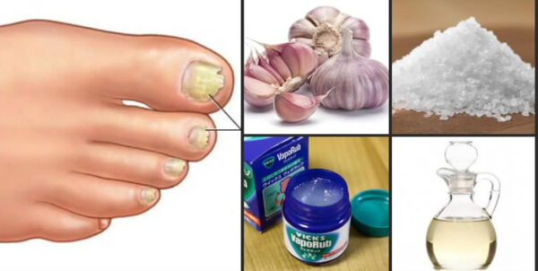 REMEDIOS CASEROS Y NATURALES PARA FORTALECER LAS UÑAS