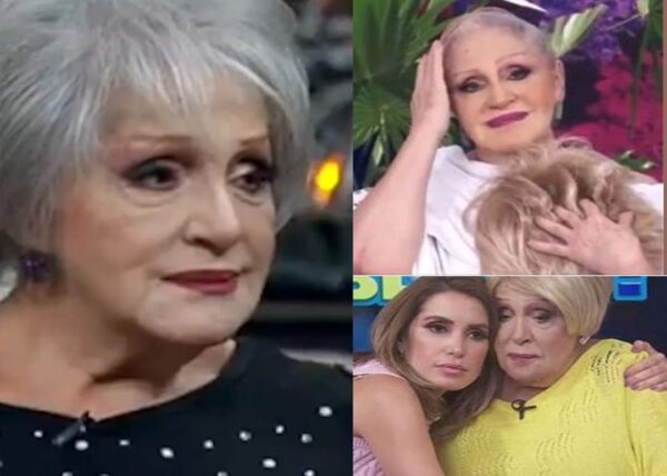 Anel Noreña se quita la peluca en el programa ‘Hoy’ y da una inspiradora lección de amor propio