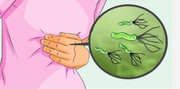 Cómo combatir la bacteria Helicobacter pylori con métodos caseros y naturales