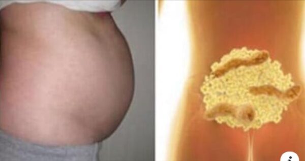 Cómo reducir el estómago agrandado y mejorar tu bienestar