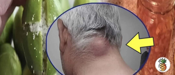 Descubre una forma natural y efectiva para eliminar los lipomas y bolas de grasa