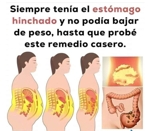 Dos infusiones para Desinflama el estómago