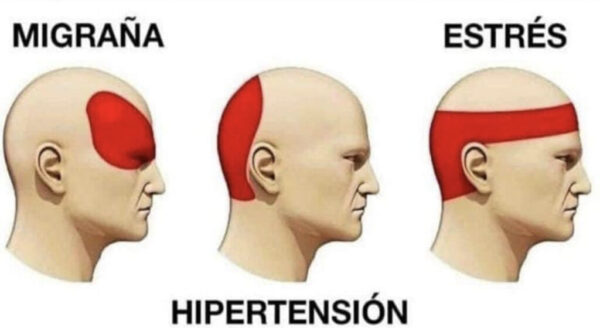El dolor de cabeza: Causas, tipos y remedios caseros