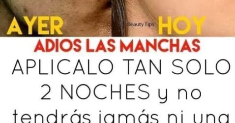 Esta mascarilla es la nueva sensación, acaba con las manchas en la piel en solo una semana